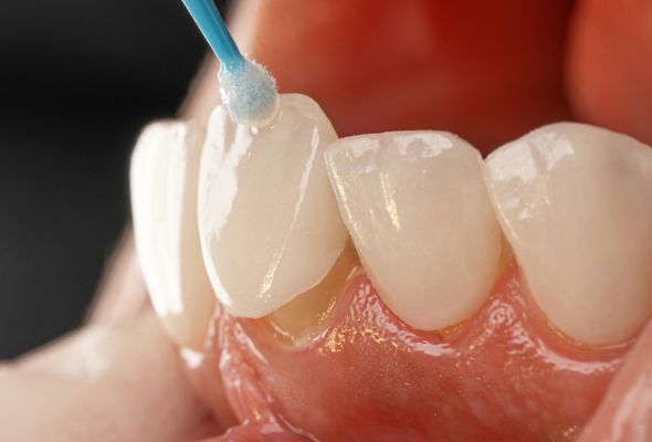 Restoration design options reviewed before milling