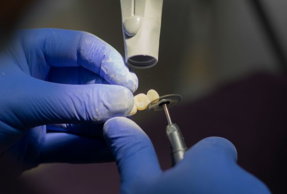 Quality assurance inspection of dental restorations