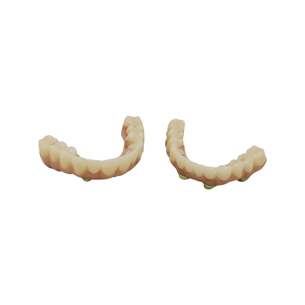 All On 4 Dental Implants Zirconia