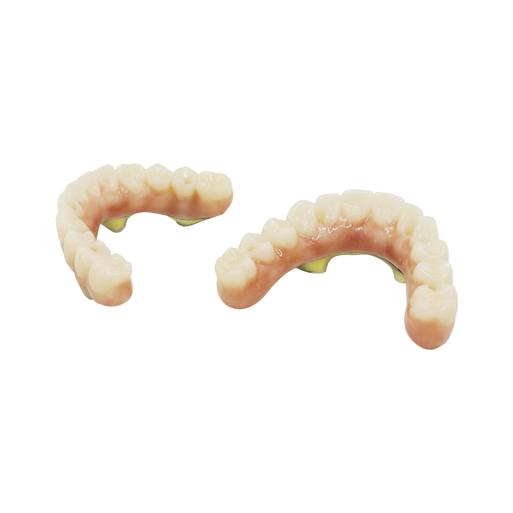 All On 4 Dental Implants Zirconia - case 2