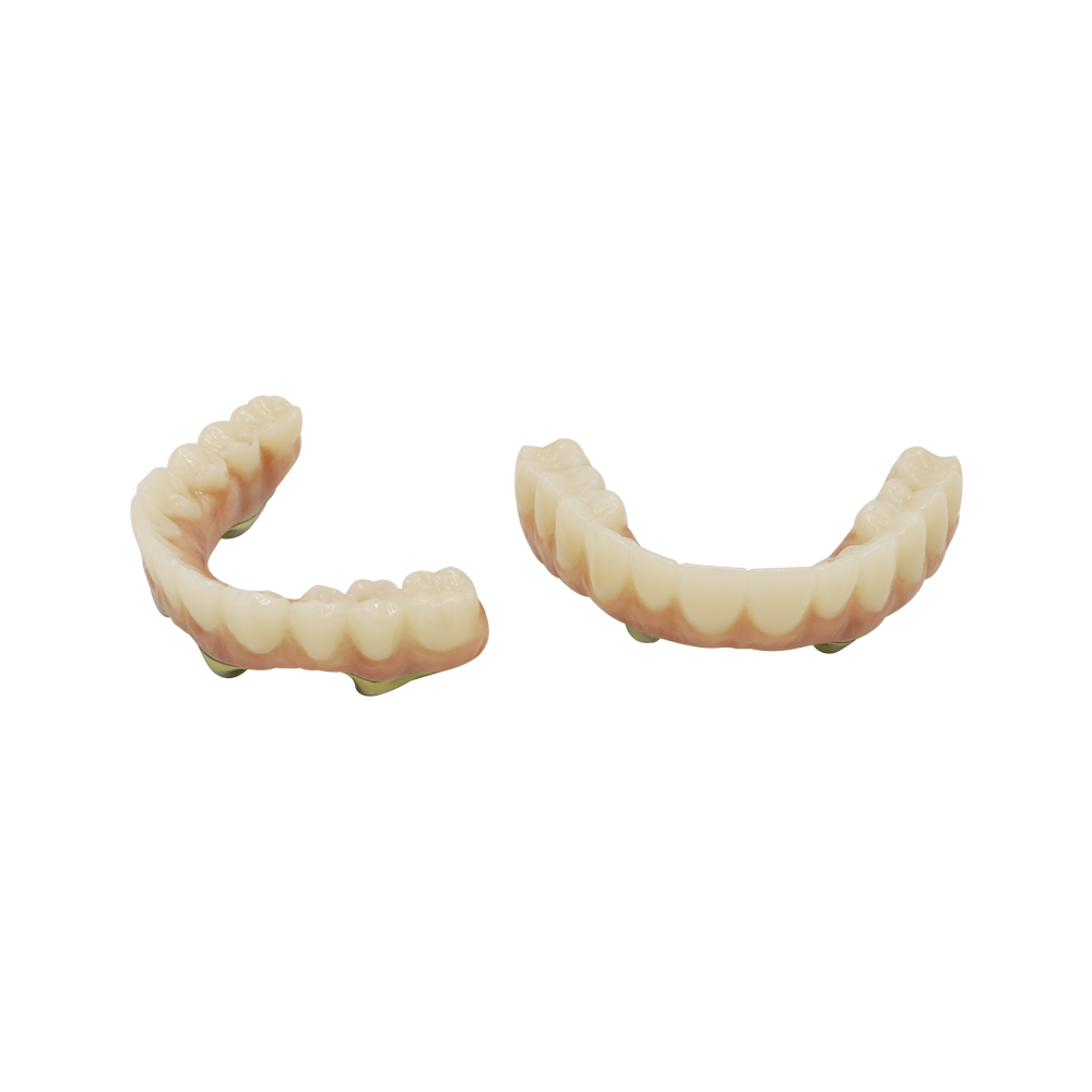 All On 4 Dental Implants Zirconia - case 3
