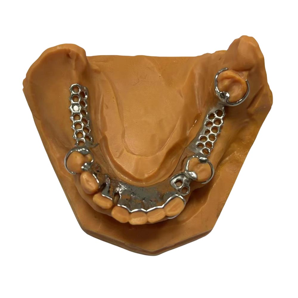 Chromium Cobalt Partial Denture, Cobalt Chrome(CoCr) Dental Plate - case 3