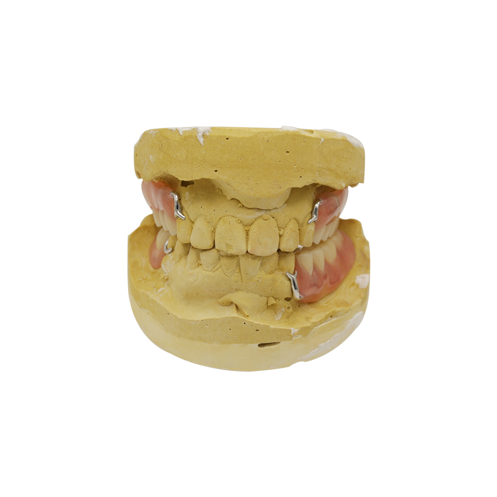 Chromium Cobalt Partial Denture, Cobalt Chrome(CoCr) Dental Plate - case 2
