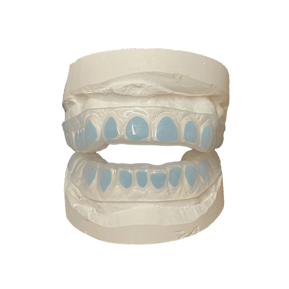 Custom Dental Whitening Plates Trays