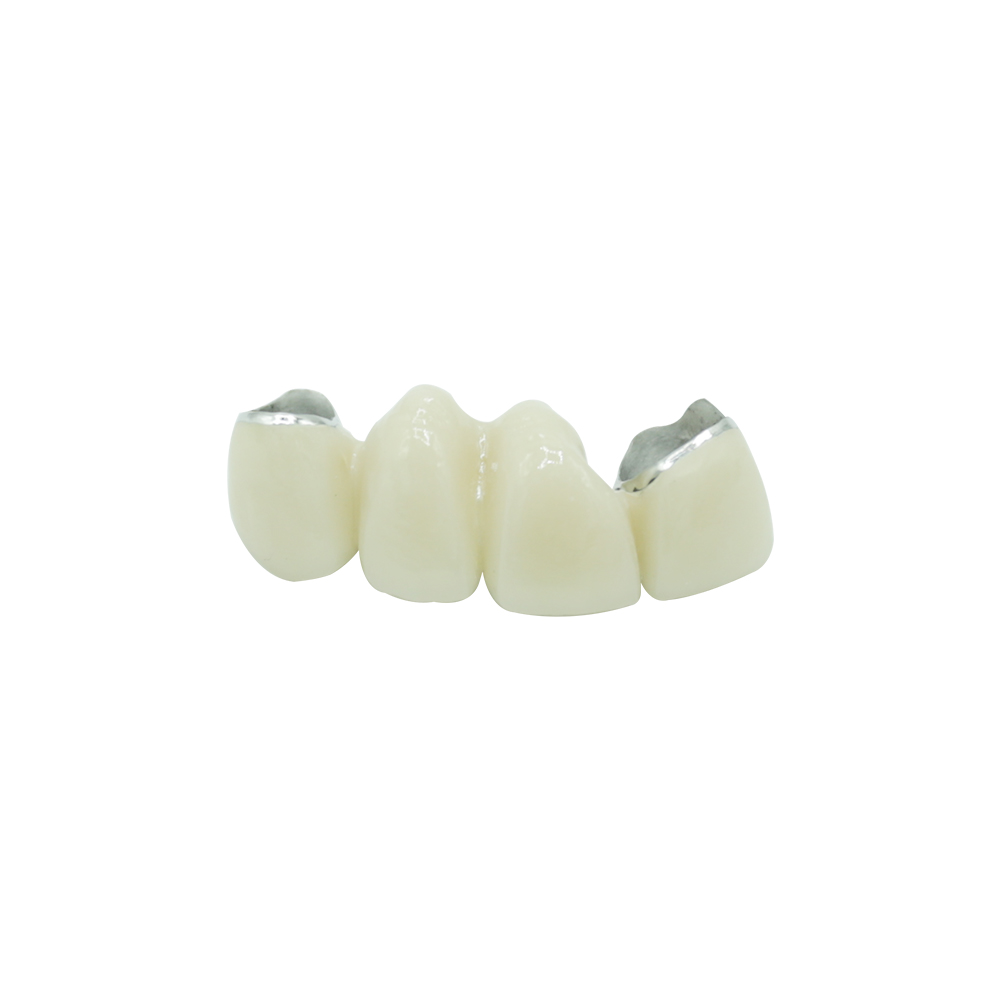Dental Metal Collar PFM Crown