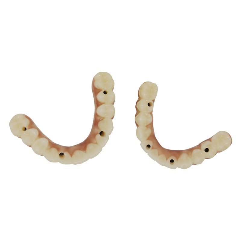 Full Mouth Zirconia Implants