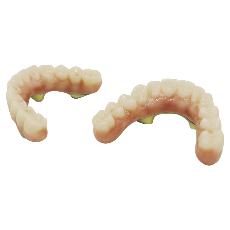 Full Mouth Zirconia Implants - case 2