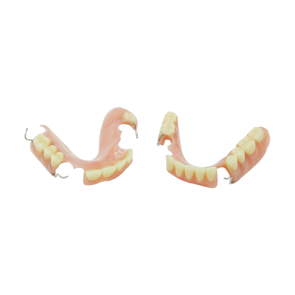 Palateless Dentures - case 2