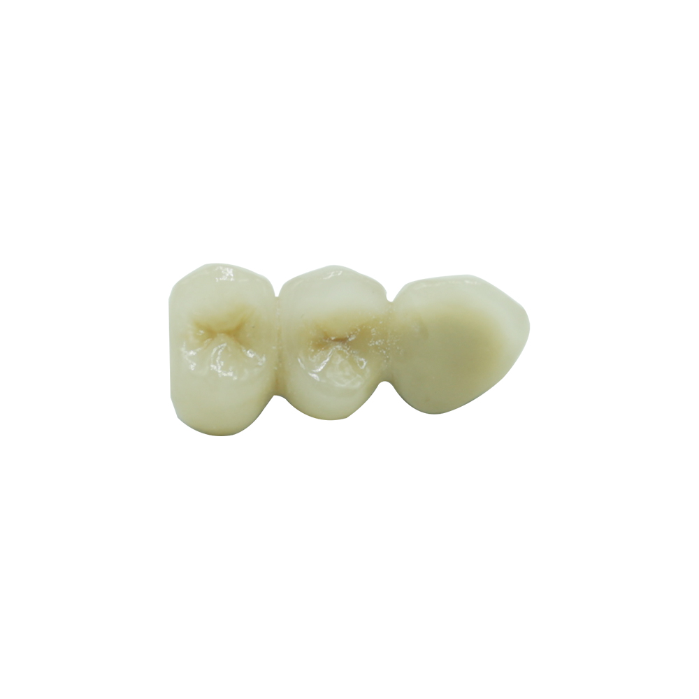 PFM Crown Premolar