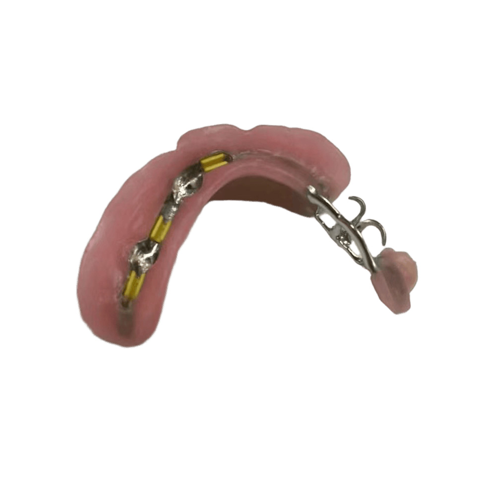 Precision Attachment Partial Denture
