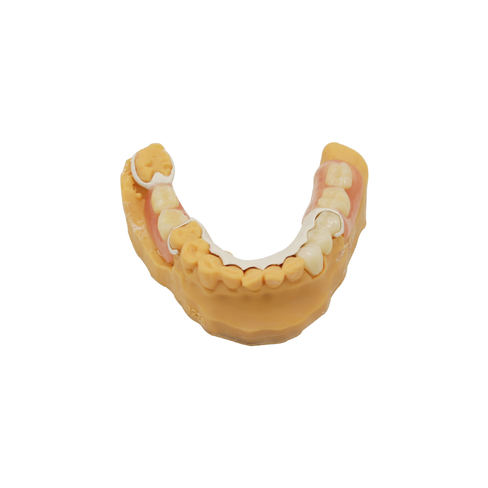 UpperLower Partial Dentures