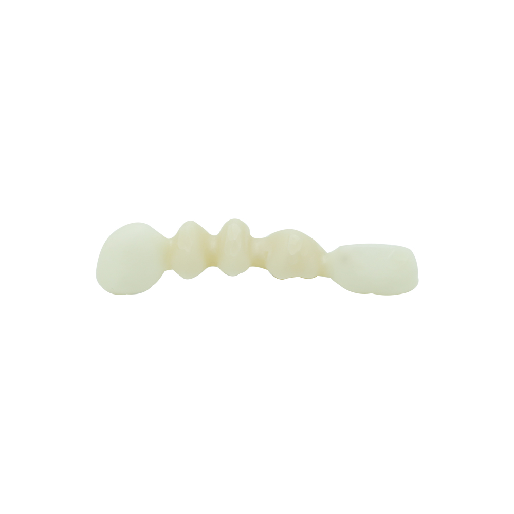 Zirconia Coping Crown - case 2