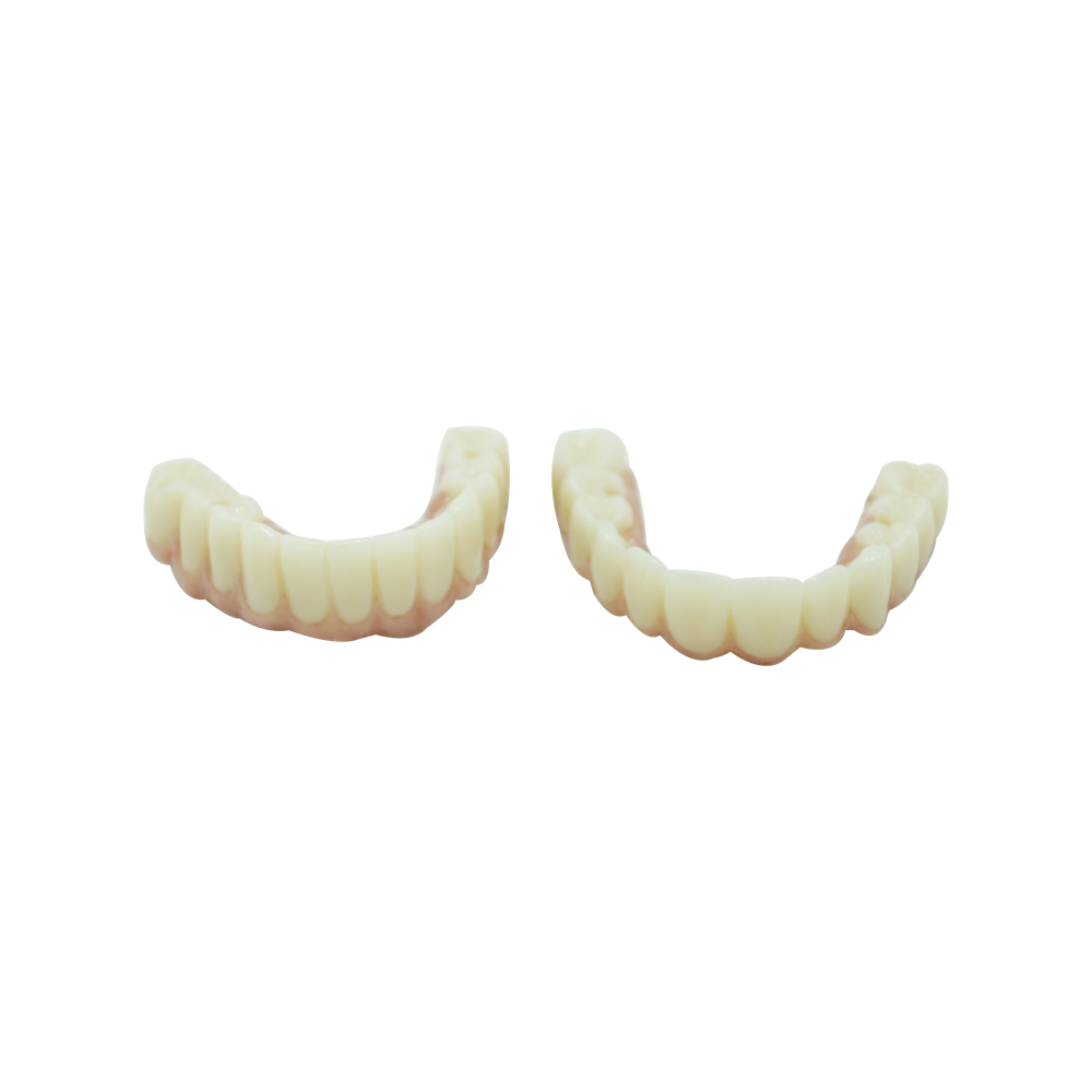 Zirconia Screw Retained Implant Crown